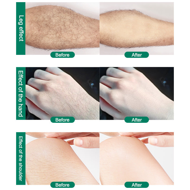 Crystal Hair Removal Magic Hair Eraser