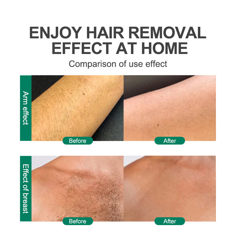 Crystal Hair Removal Magic Hair Eraser