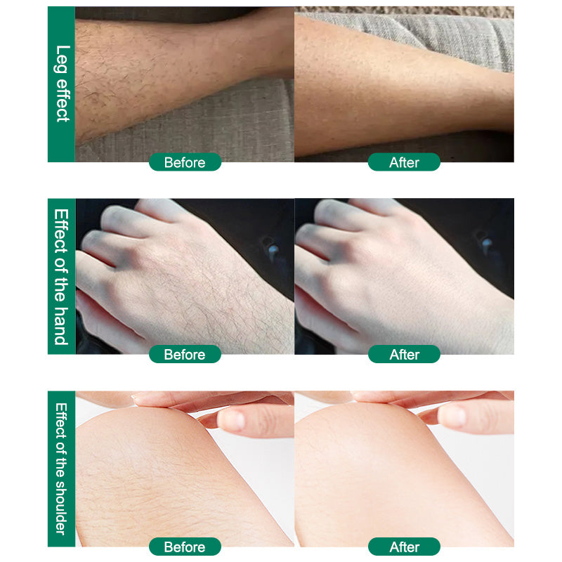 Crystal Hair Removal Magic Hair Eraser